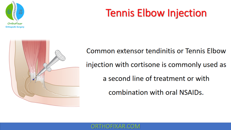 Tennis Elbow Injection