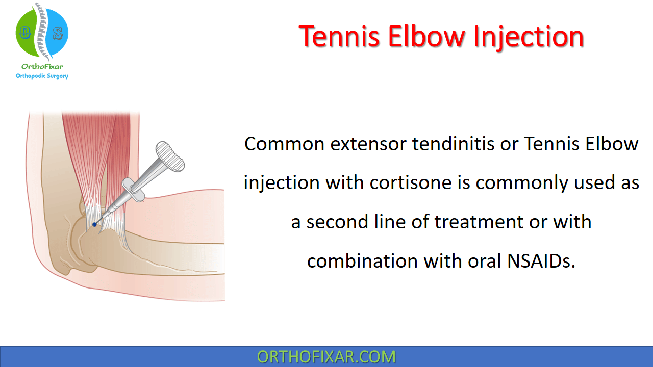 tennis elbow injection