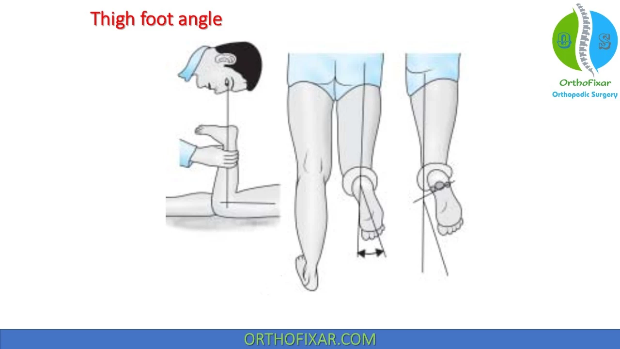 Thigh foot angle