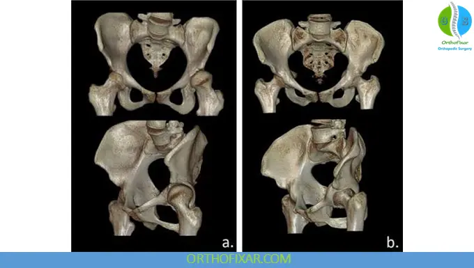 Three-Dimensional CT Reconstruction