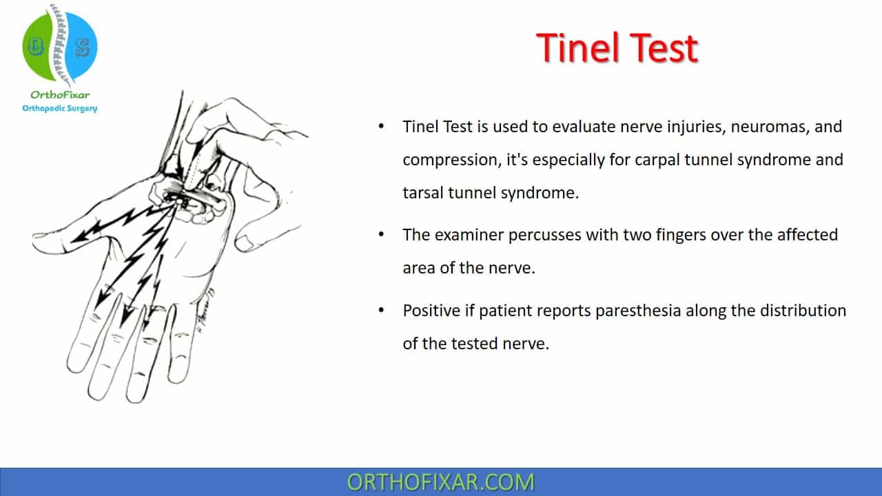 Phalen & Reverse Phalen Test | OrthoFixar 2025