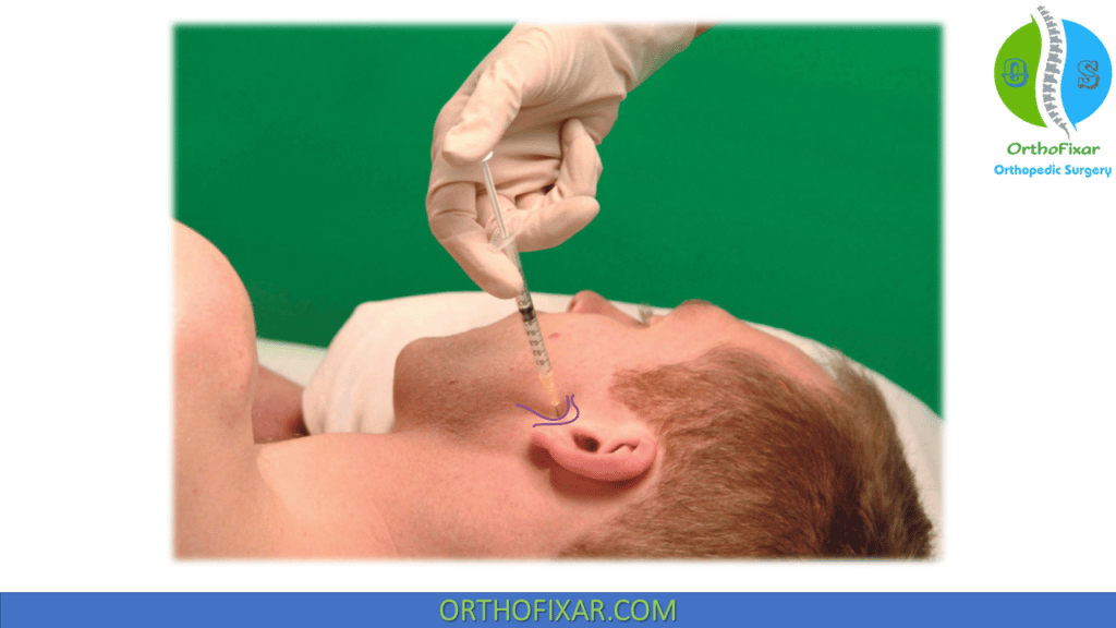 Tmj Steroid Injection