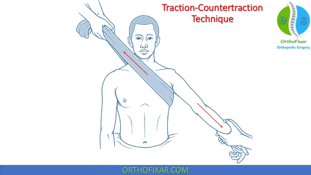 Traction-Countertraction Technique