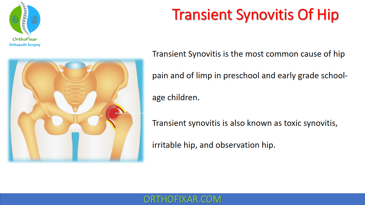  Transient Synovitis Of Hip 