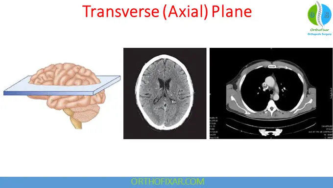 Transverse Plane