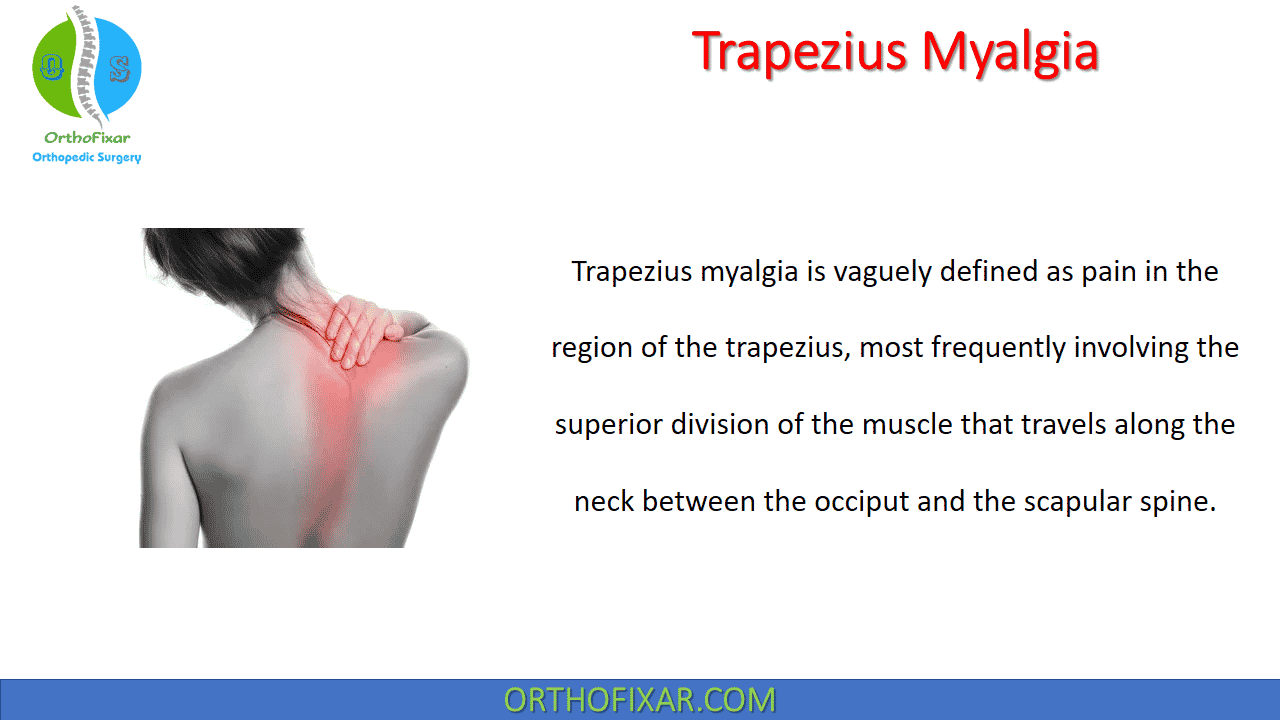 Trapezius Myalgia