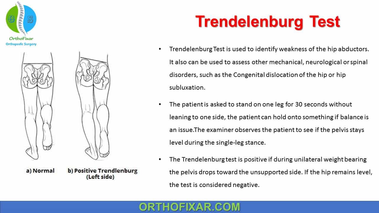 Hip Special Tests - Trendelenburg Test