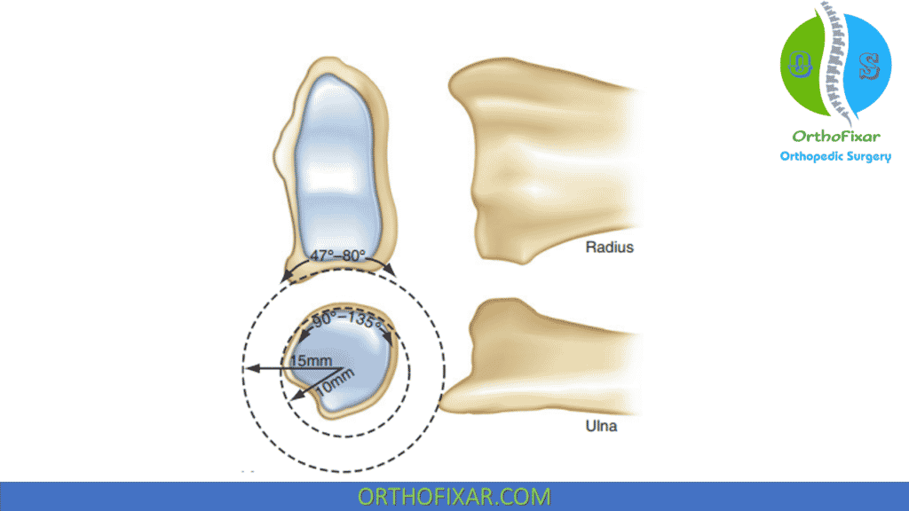 Triangular Fibrocartilage Complex anatomy (1)