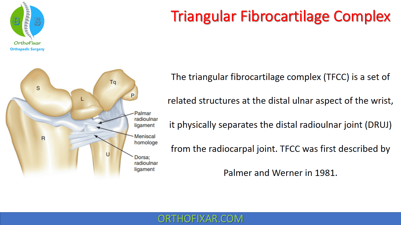 Triangular Fibrocartilage Complex OrthoFixar | atelier-yuwa.ciao.jp