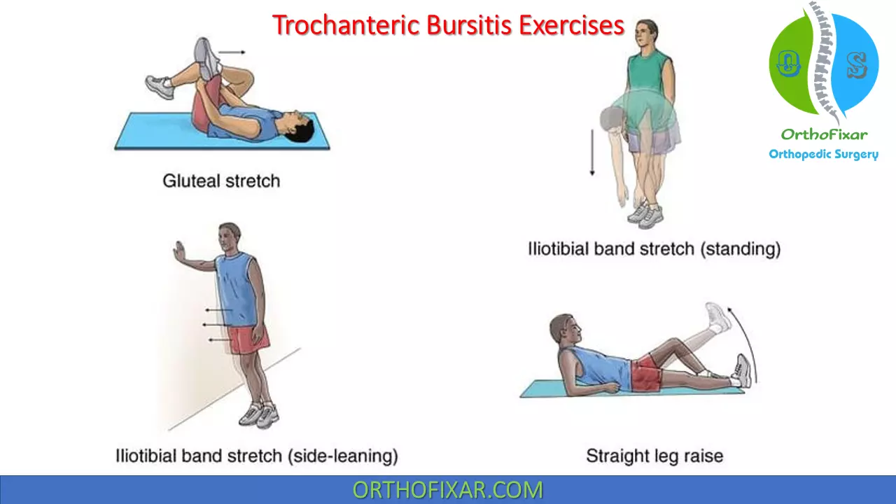 trochanteric bursitis exercises