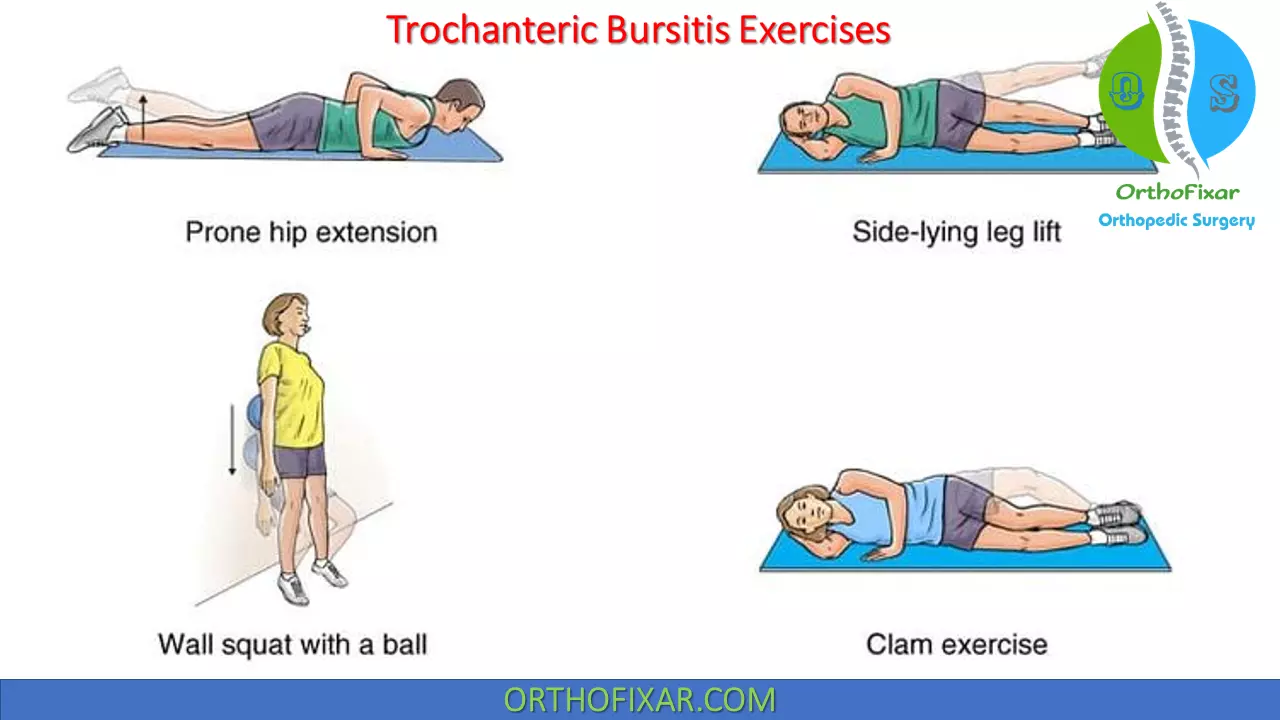 Trochanteric Bursitis exercises