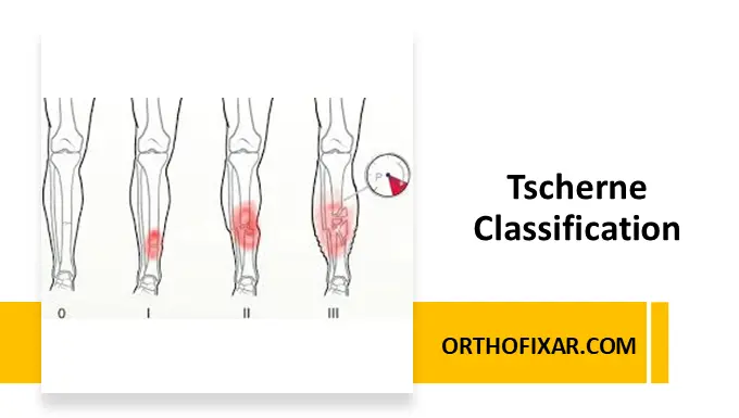 Tscherne Classification