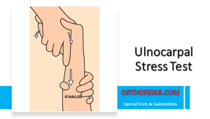 Ulnocarpal Stress Test