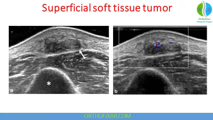 Ultrasound Imaging