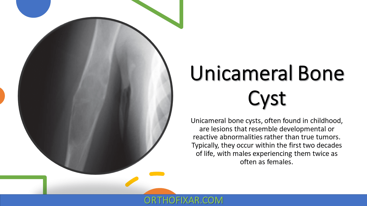 Unicameral Bone Cyst