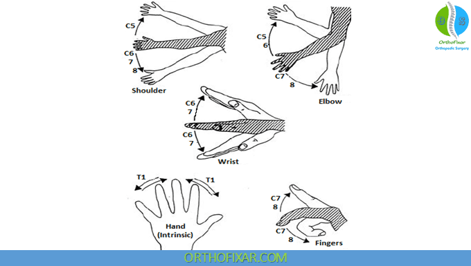 Myotomes Of The Upper Limb | OrthoFixar 2025