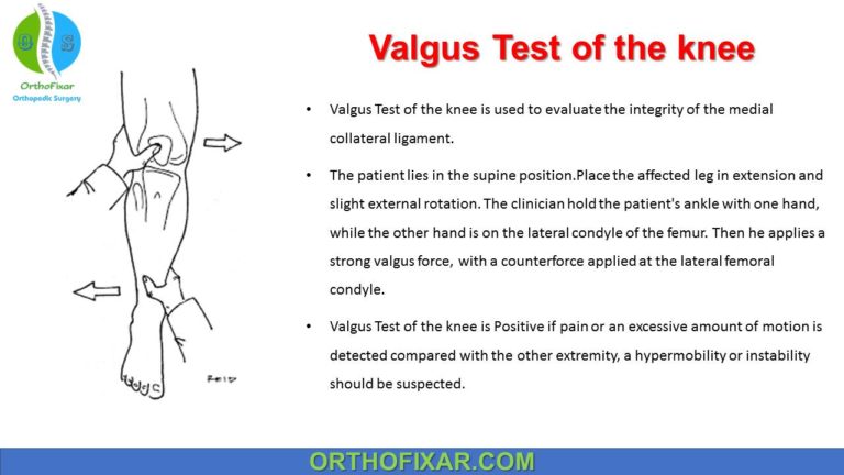 Valgus stress test of the knee