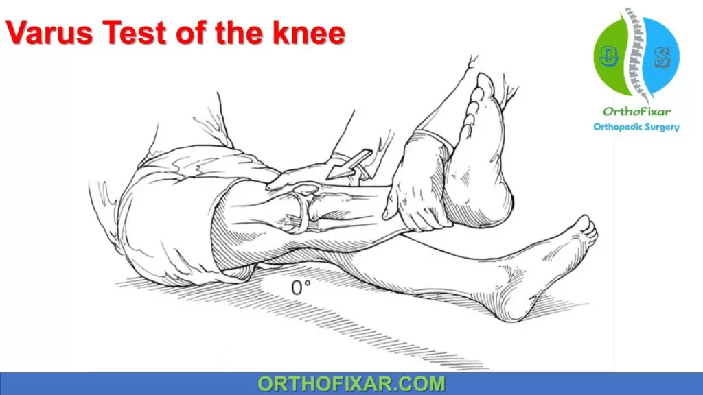 Varus Test of the knee 