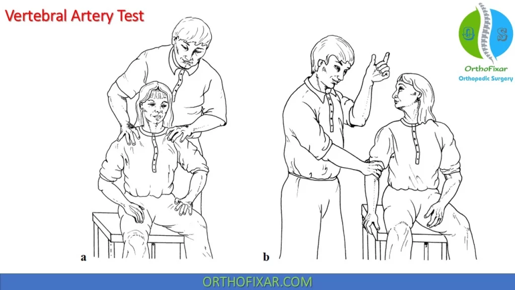 Vertebral Artery Test - seated position