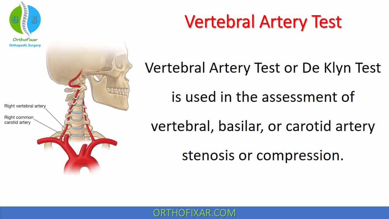  Vertebral Artery Test 