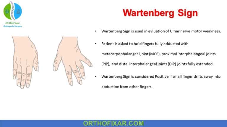 Wartenberg Sign