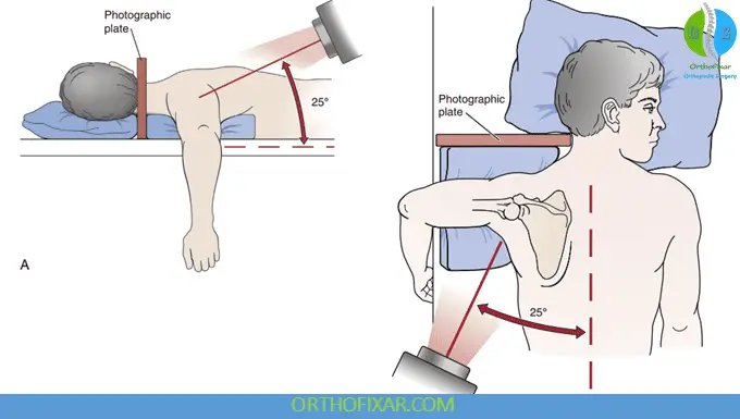 Shoulder X-ray Views 5 West Point axillary view