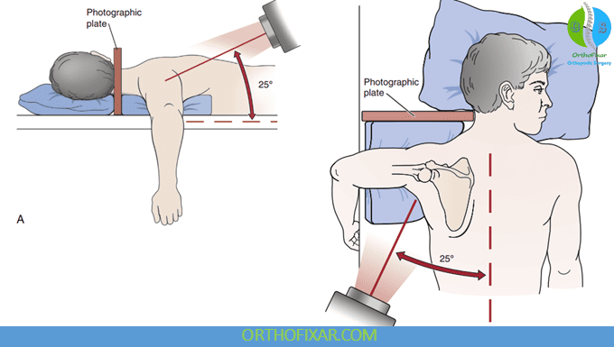 Shoulder X ray Views