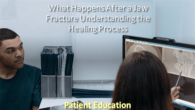 What Happens After a Jaw Fracture Understanding the Healing Process