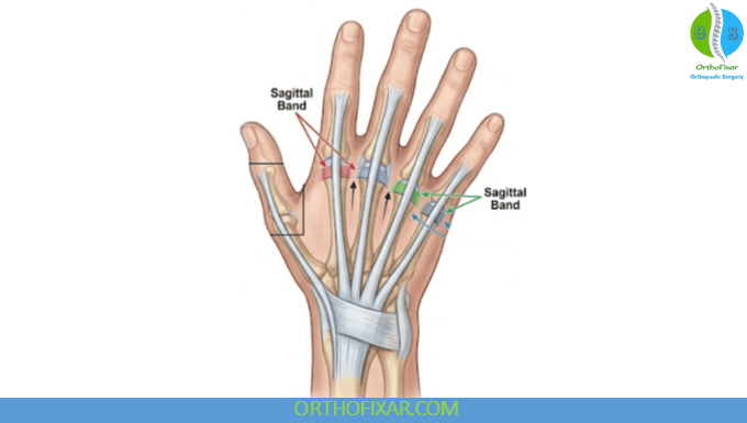 Sagittal Band Injury: Boxer’s Knuckle Symptoms & Treatment 5 What Is the Sagittal Band