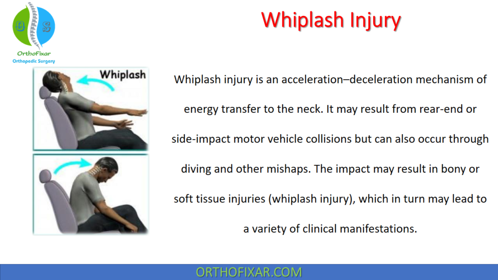 Whiplash Injury Diagnosis, Symptoms & Treatment | 2026