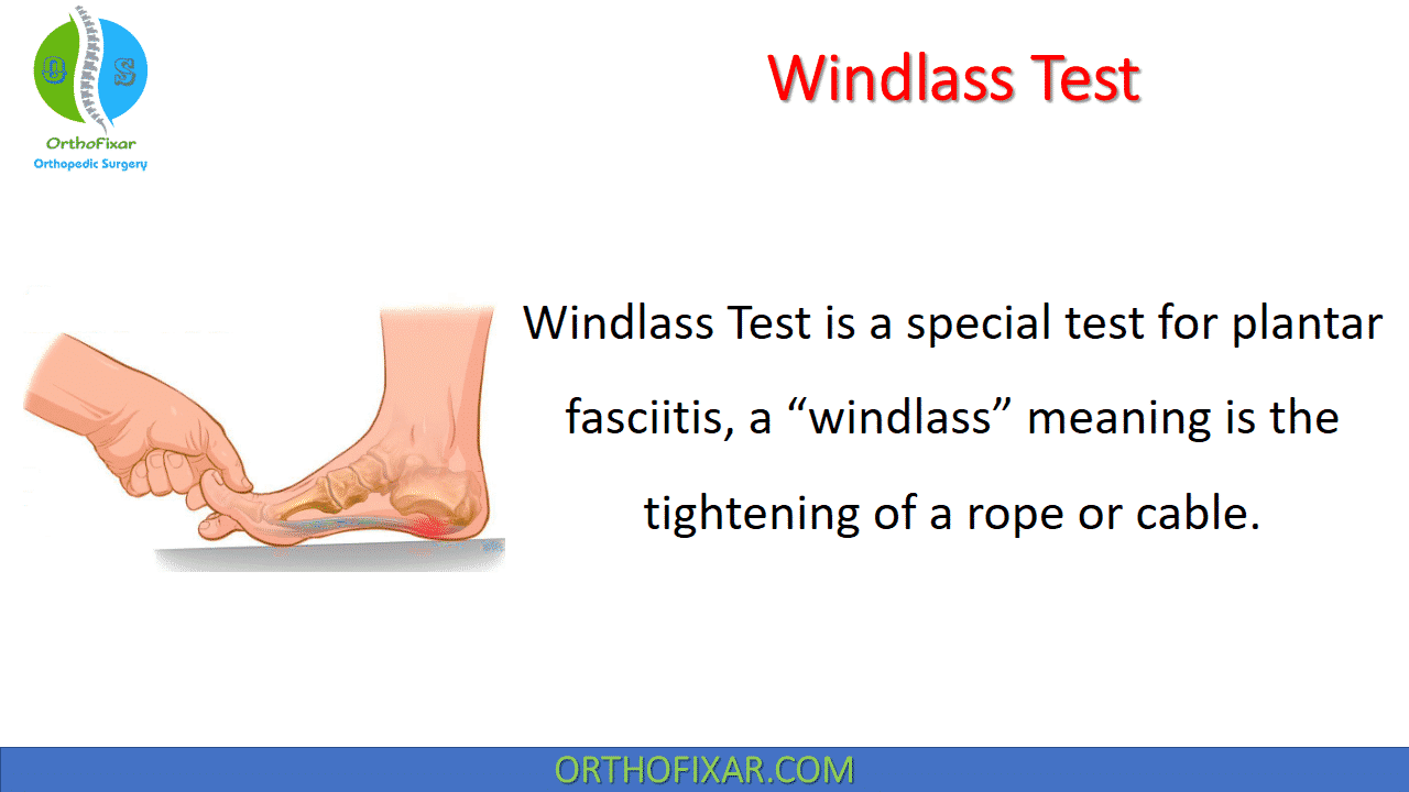  Windlass Test 