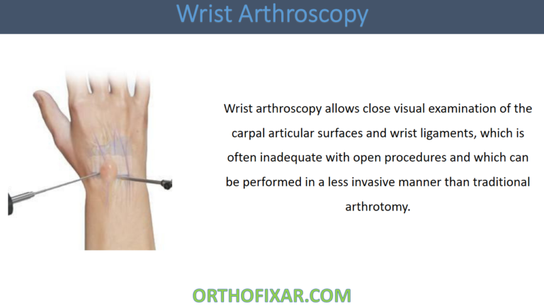 Wrist Arthroscopy