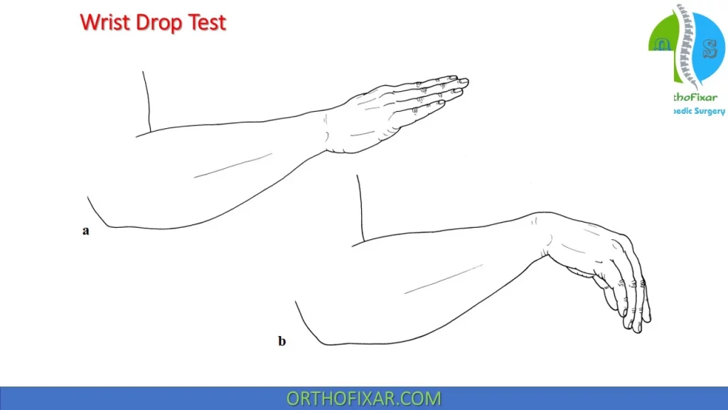 Radial Nerve Palsy Test