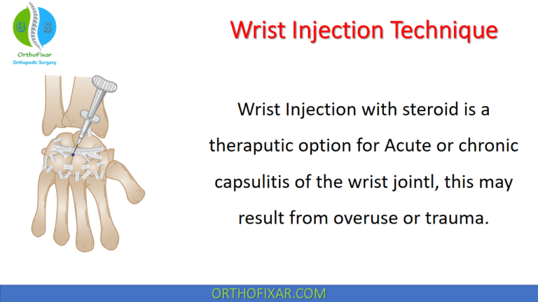 Wrist Injection Technique