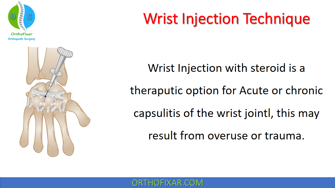  Wrist Injection Technique 
