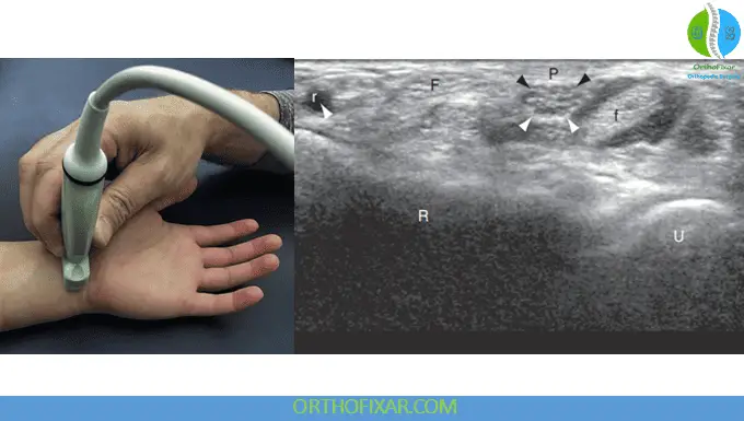 Wrist Ultrasound Imaging- Transverse view of carpal tunnel