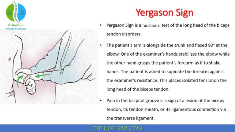 Yergason test