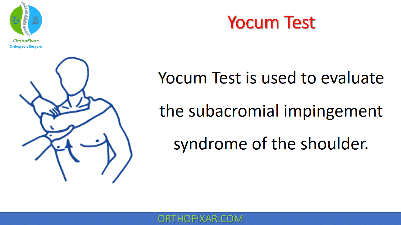  Yocum Test for Subacromial Impingement Syndrome 