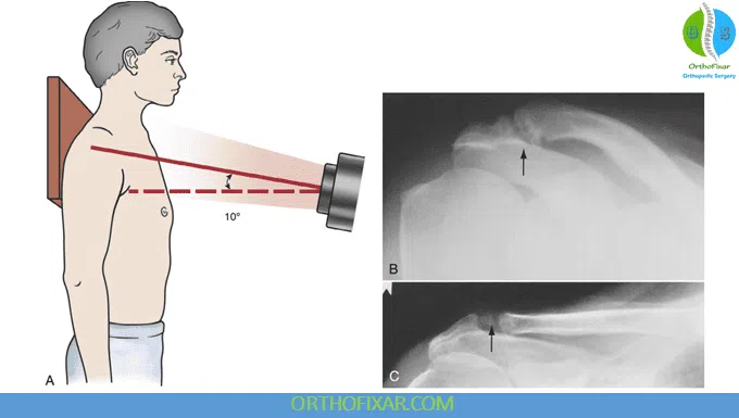 shoulder-x-ray-views