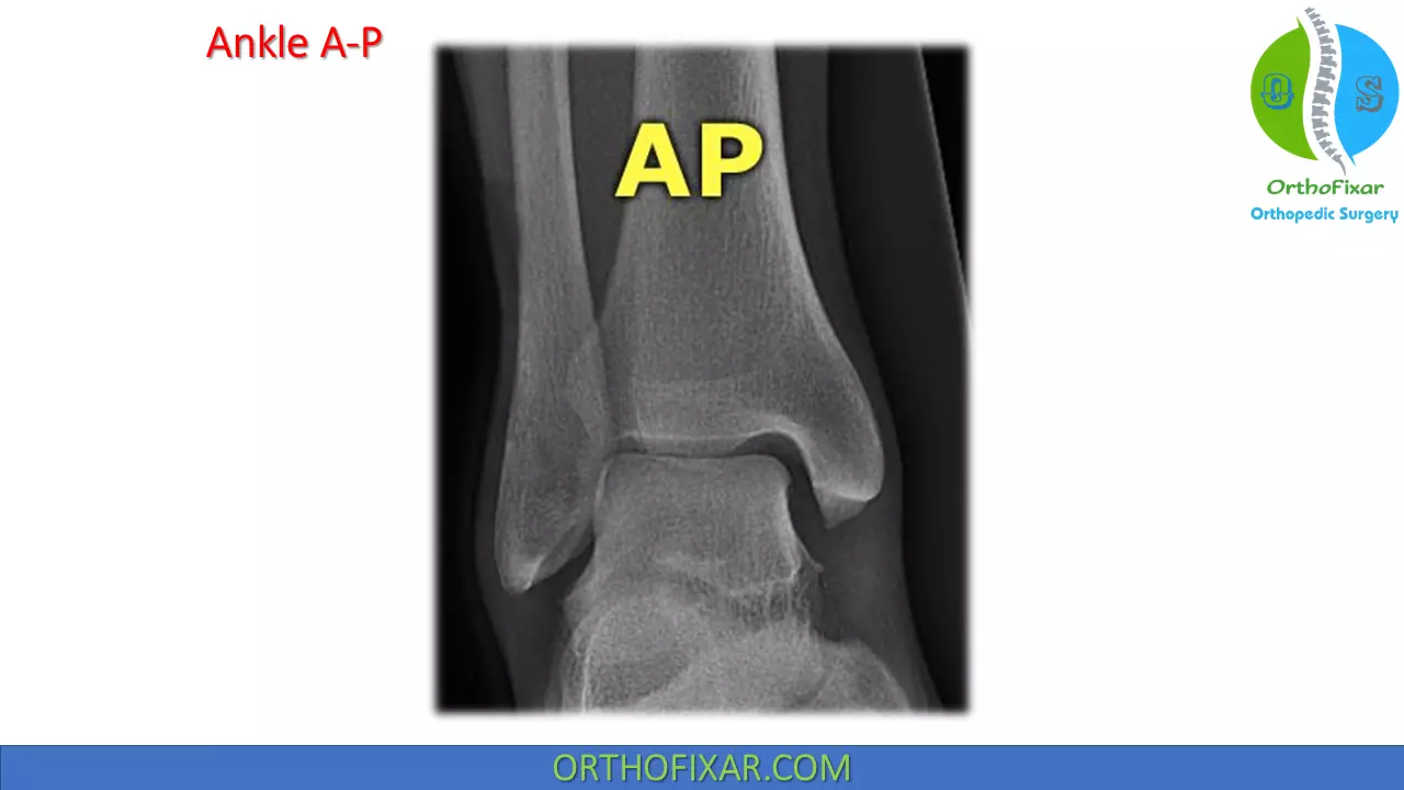 ankle AP view