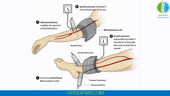 ankle brachial index test