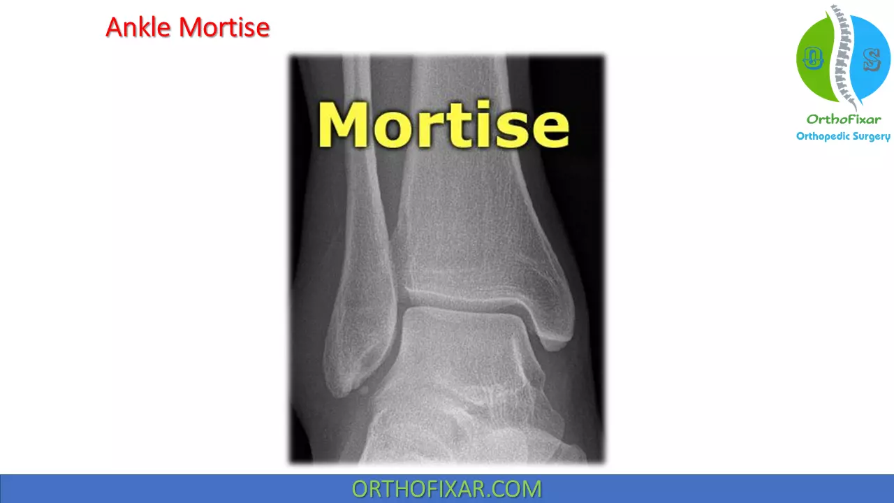 ankle mortise view