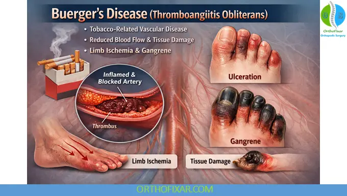 buerger's disease cause