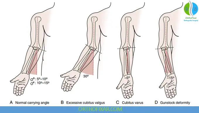 carrying angle values