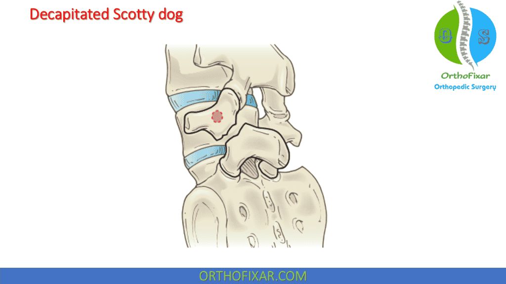 decapitated Scotty dog sign