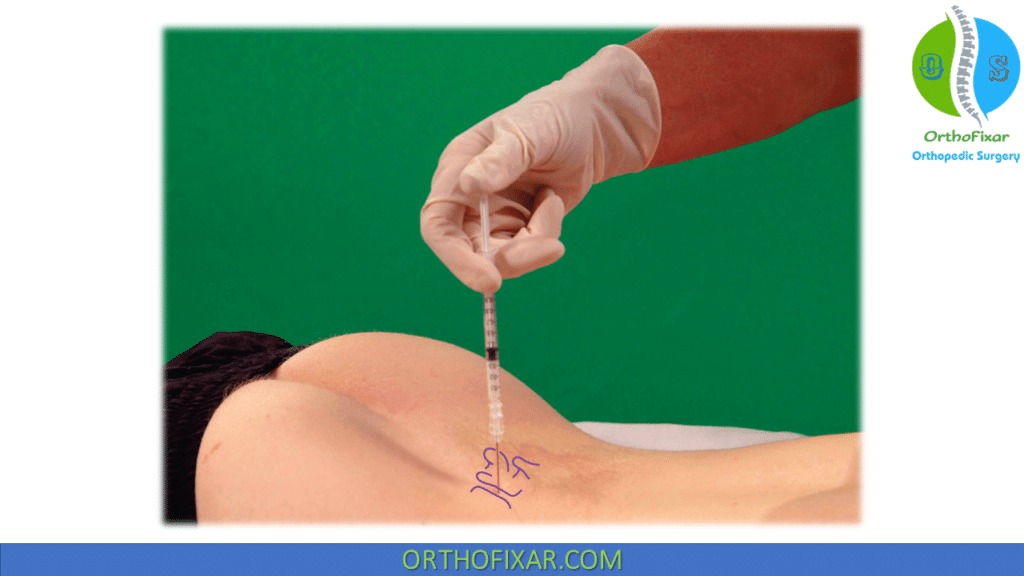 facet joint injection