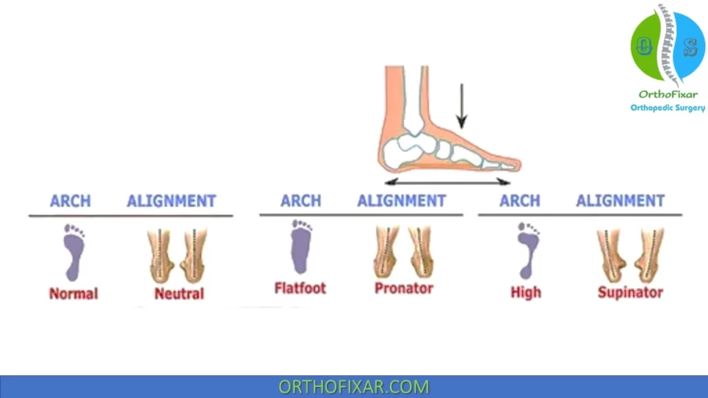 foot postures