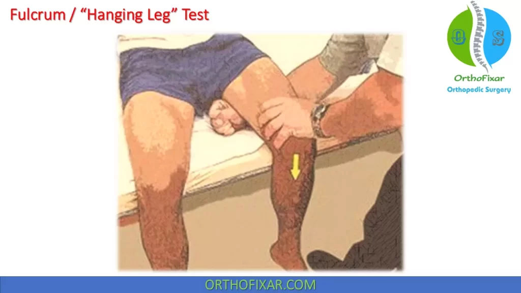 fulcrum or “hanging leg” test