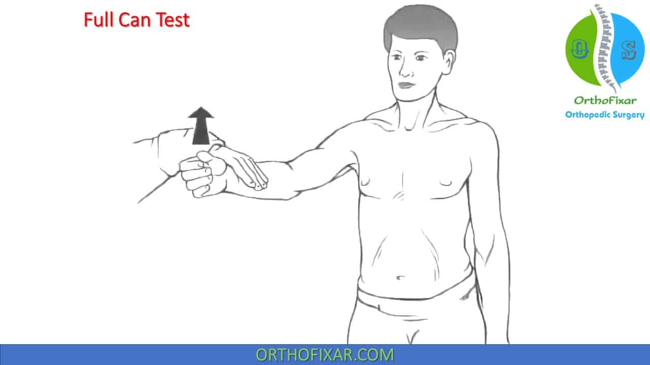 Empty Can Test For Supraspinatus Impingement - OrthoFixar 2025