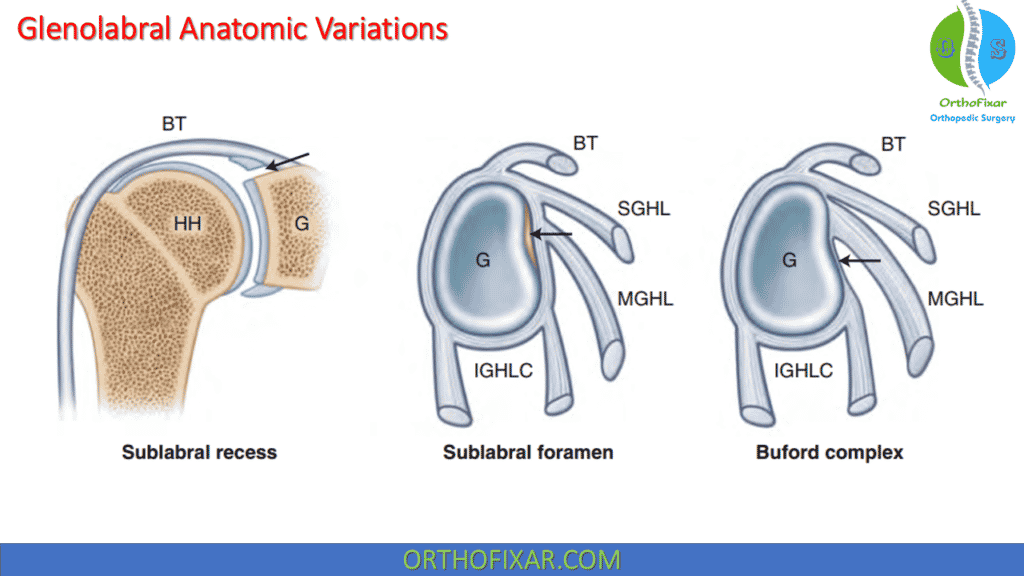 glenolabral anatomic variations
